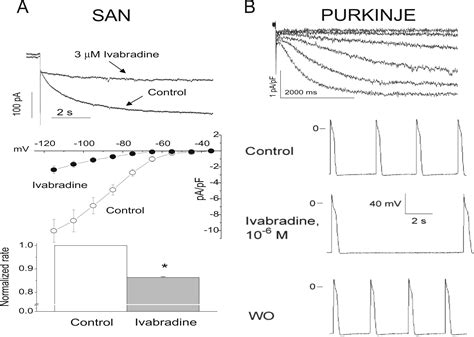 Cardiac Purkinje Fibers And Arrhythmias The Gk Moe Award Lecture