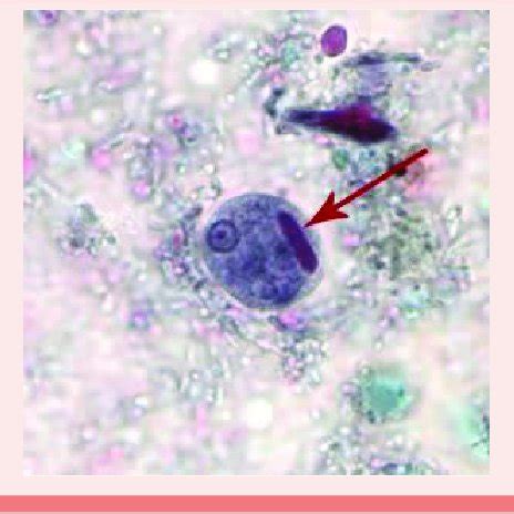 Cyst Of E Histolytica Trichrome Staining Download Scientific Diagram ...