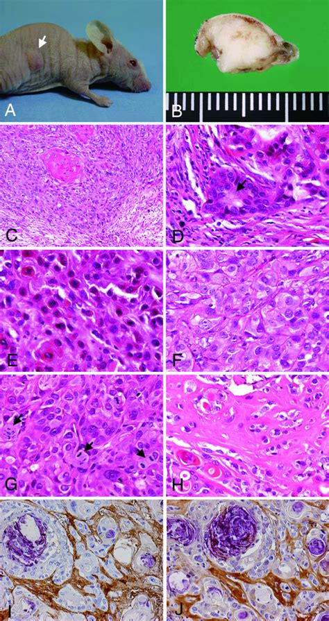 Transplanted Tumors Of SM AP Cell Systems In Nude Mice Macroscopic