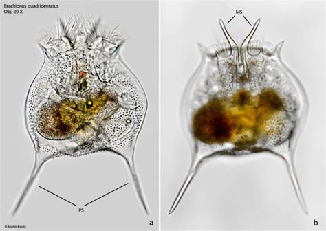 Brachionus Quadridentatus Real Micro Life