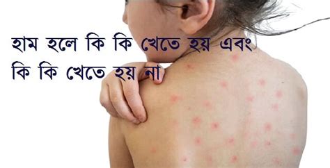 ham hle ki khete hz ebng ki ki khete hz na  nursing bd