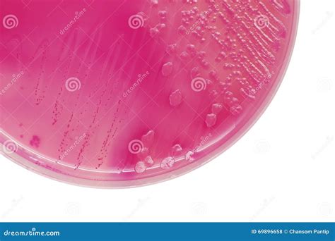 E. Coli On MacConkey Agar Royalty-Free Stock Photography | CartoonDealer.com #2055827