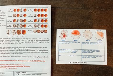 Discover Your Blood Type At Home • Noyoucantcallmeliz