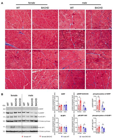 Muscle Morphology And Quantification Of Proteins Regulating Growth And