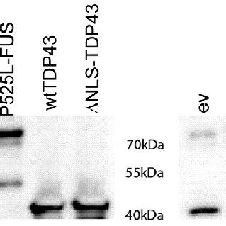 Expression Of Transfected Wild Type And Mutant Fus And Tdp In Sh Sy Y