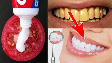 como blanquear los dientes en casa rápido con TOMATE y su diente