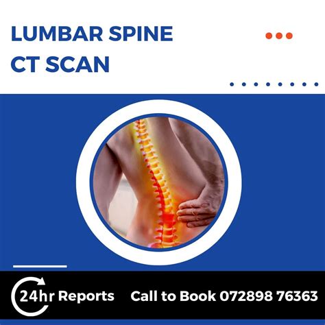 Lumbar Spine CT Scan @ Rs 1600 | Call 7289876363