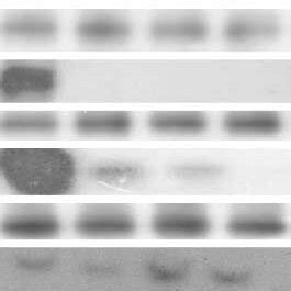 A Gsh Levels In Different Tumor Cell Lines And Normal Hepatocytes At