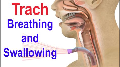 Trach Breathing And Swallowing YouTube