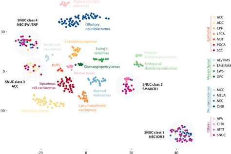 A New Machine Learning Algorithm Classifies Sinonasal Tumors Based On