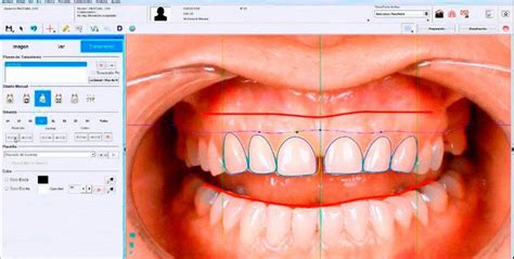 odontología mínimamente invasiva 1080x545 ClinicaForumDental