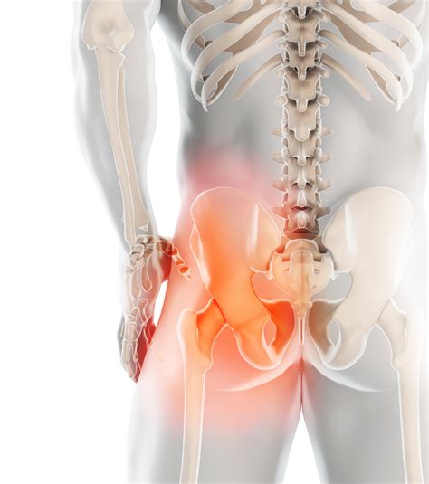 What Is A Hip Impingement? | The Bone & Joint Center
