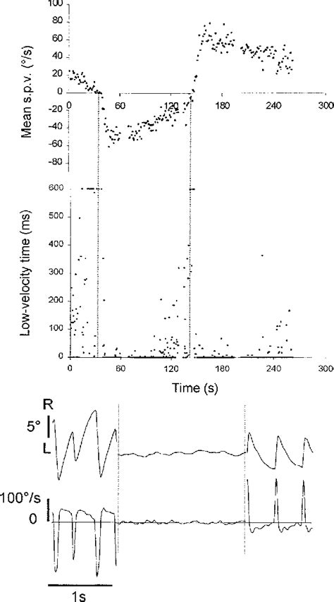 Figure From The Incidence And Waveform Characteristics Of Periodic