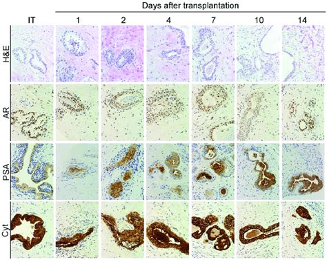 Primary Xenografts Of Human Prostate Tissue Maintain The In Vivo Tissue