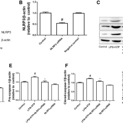 Exogenous H S Attenuated The Protein Level Of Nlrp Inflammasome