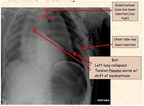 EmDOCs Net Emergency Medicine EducationMedical Malpractice Insights