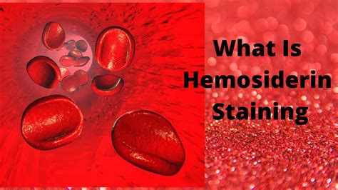 What Is Hemosiderin Staining Youtube