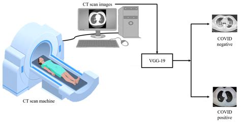 System Flow Diagram The Ct Scan Machine Gives The Ct Scan Image Of A