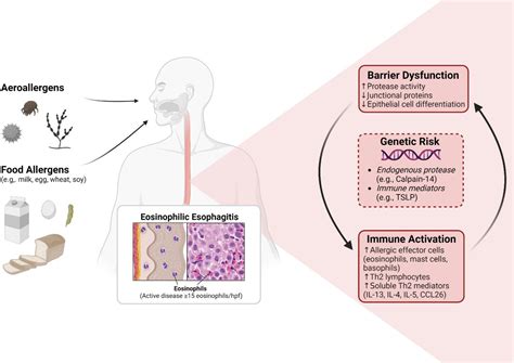 Breaking Down The Complex Pathophysiology Of Eosinophilic Esophagitis