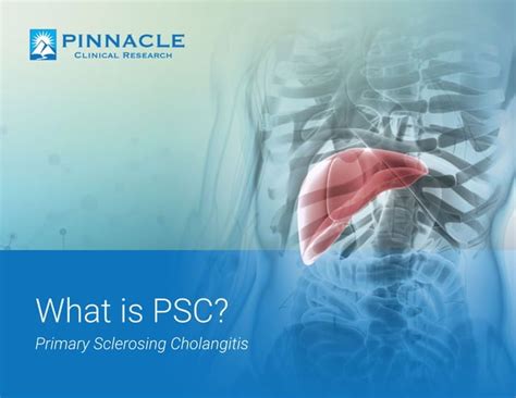 Primary Sclerosing Cholangitis Psc Ppt