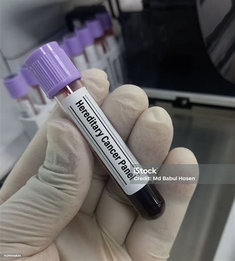 Scientist Holding Blood Sample For Hereditary Cancer Panel Test To