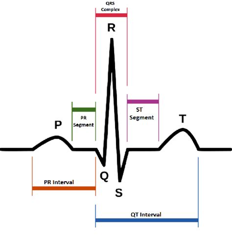 The morphology of QRS complex in a normal sinus ECG signal. | Download ...