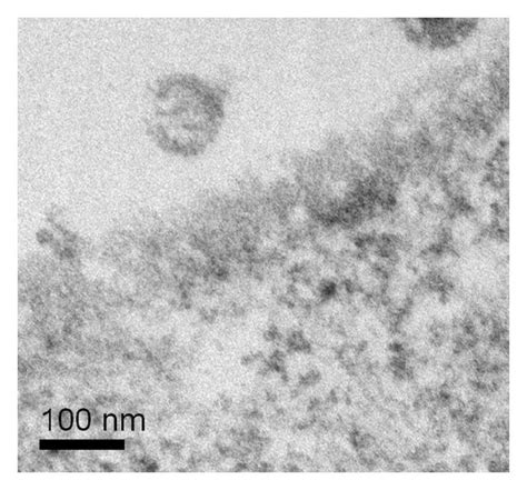 Cell Surface Immunogold Labeling And Electron Microscopy Of Infected