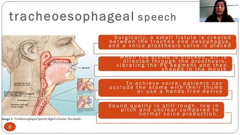 Esophageal Speech Youtube