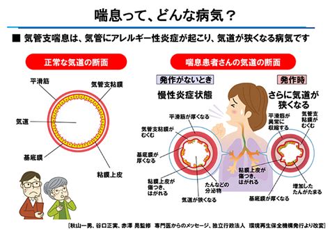 喘息（診断検査）｜診療案内｜かたえ内科・呼吸器クリニック