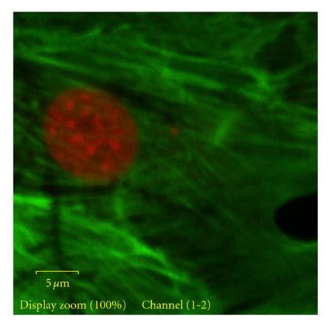 Phalloidin Stained Actin Filaments Of Osteoblasts Grown On Silicone