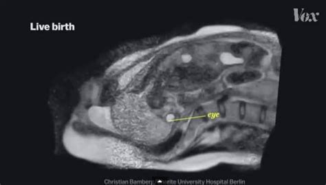 Yes You Want To Know What Sex In An Mri Scanner Looks Like