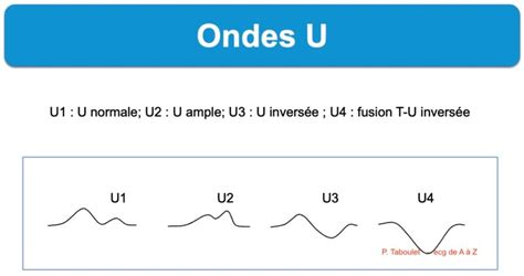 Onde U E Cardiogram