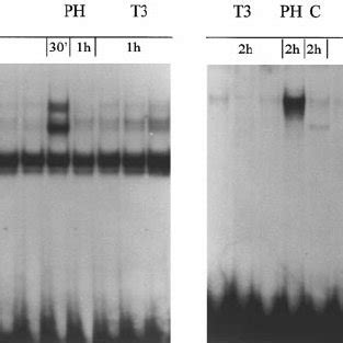 Dna Binding Activity Of Nf B And Ap Transcription Factors In The