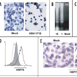 HSV 1716 Oncolytic Effect On ID8 VEGF Syngeneic Tumor Model A Tumor