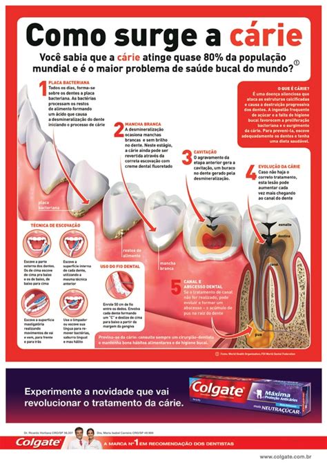 Evolu O Da C Rie Dent Ria Colgate Profissional