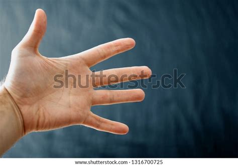 Raynaud Syndrome: Over 110 Royalty-Free Licensable Stock Photos ...