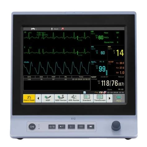 Edan X12 Multi Parameter Patient Monitor With 12 1 Inch Touch Screen