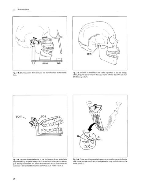 Fundamentos Esenciales En Protesis Fija Shillingburg PDF