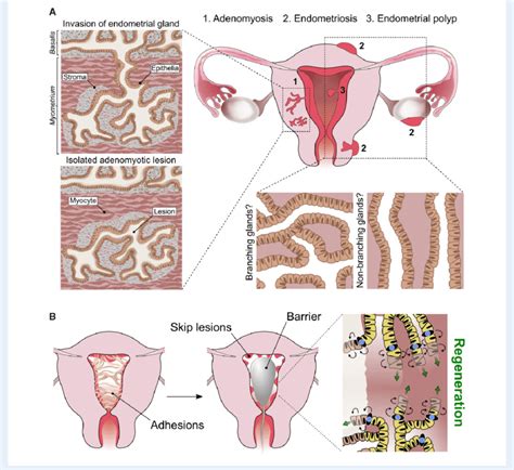 Relevance Of Epithelial Histoarchitecture To Endometrial Pathologies