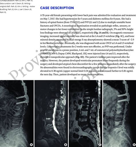 The diagnosis and treatment of acute osteoporotic vertebral compression ...