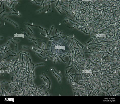 Bacillus Anthracis Micrograph Fotograf As E Im Genes De Alta Resoluci N