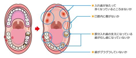 観察のポイント はじめようやってみよう 口腔ケア