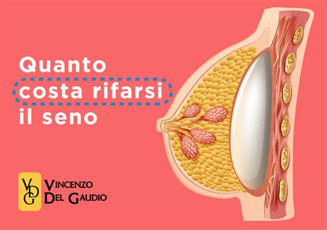 Quanto Costa Rifarsi Il Seno In Italia I Vantaggi Del Dott Del Gaudio