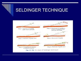 Angiography basics and seldinger technique | PPT | Free Download