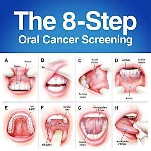 HPV Bumps On Your Tongue - HPV Hub, LLC