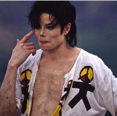 Vitiligo Michael Jackson Proof