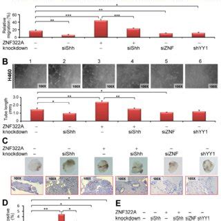 Yy Znf A Shh Axis Regulated Angiogenesis In Vitro And In Vivo A And