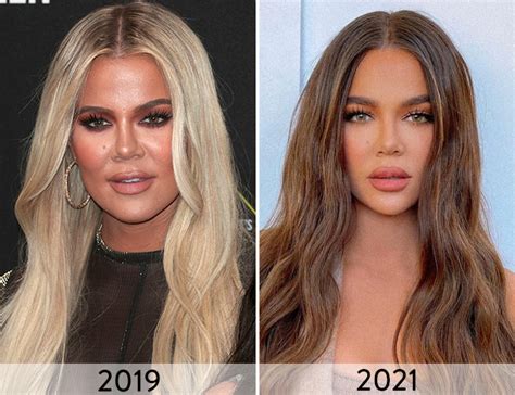 Khloé Kardashian Then And Now See How Much Her Face Has Changed Over The