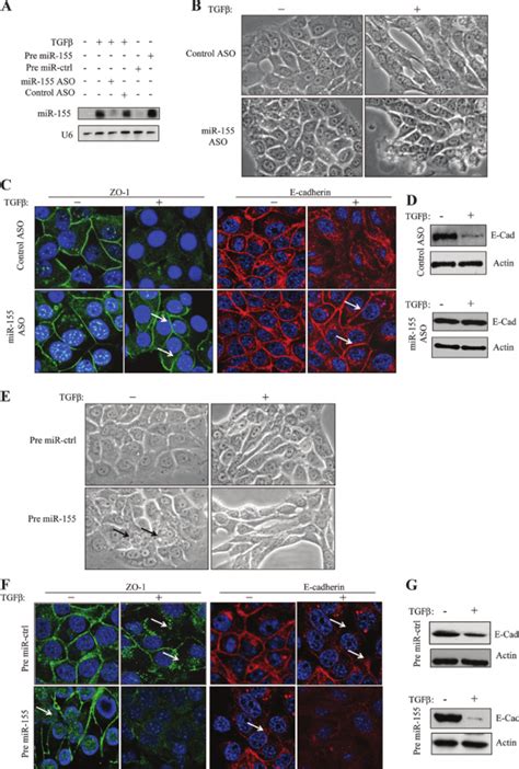 MiR 155 Mediates The Effect Of TGF On EMT A Ectopic Expression