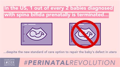 Advancements In Fetal Surgery For Treating Spina Bifida Lozier Institute